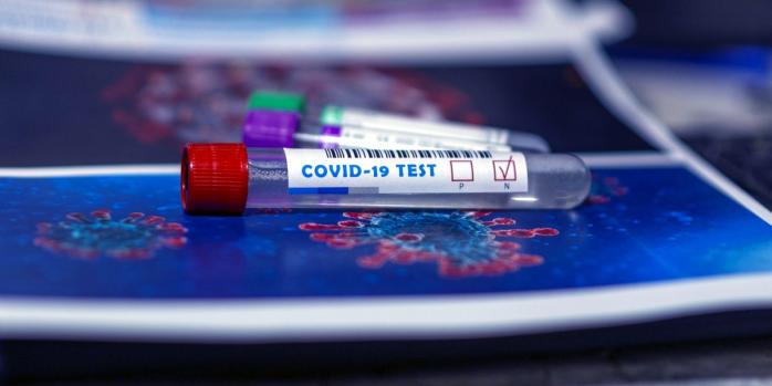 Низку випадків підробки тестів на коронавірус виявили прикордонники, фото: