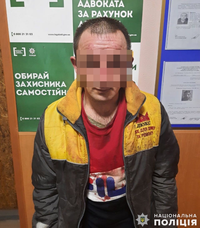 Мужчина на Николаевщине облил неизвестной химвеществом свою семью, фото: Национальная полиция