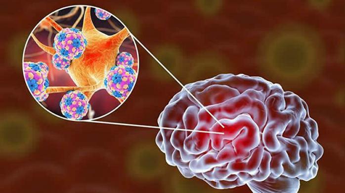 Вчені довели небезпеку коронавірусу для судин мозку, фото — РІА