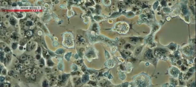 Заражені коронавірусом клітини. Фото: NHK