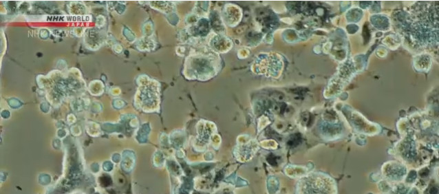 Зараженные коронавируса клетки. Фото: NHK