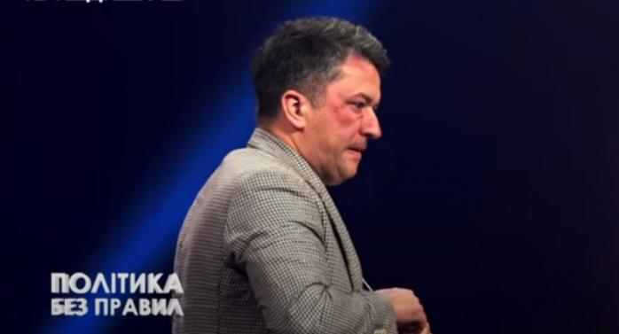 Драка в прямом эфире — экс-нардеп Порошенко поставил синяка «слуге», скриншот видео