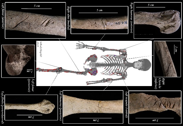 Місця пошкоджень на скелеті, інфографіка: Julia White et al. / Journal of Archaeological Science: Reports, 2021