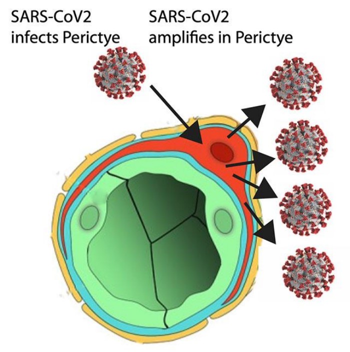 На рисунке изображен SARS-CoV-2, который распространяется по кровеносным сосудам (зеленый цвет) для заражения перицитов (красный), которые усиливают инфекцию и могут распространять инфекцию на другие типы клеток мозга. Инфографика: UC San Diego Health Sciences