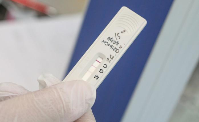 Чому не варто тести на антитіла до коронавірусу, пояснили в МОЗ. Фото: Слово і діло