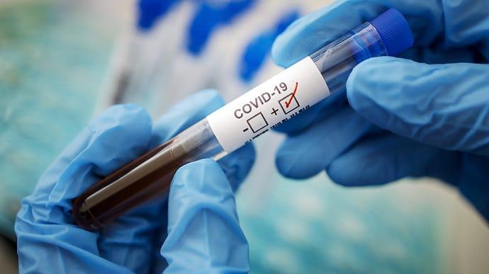 Лікувати коронавірус засобом від глистів запропонували вчені. Фото: УП