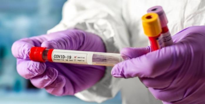 В Україні триває епідемія коронавірусу, фото: «Слово і Діло»