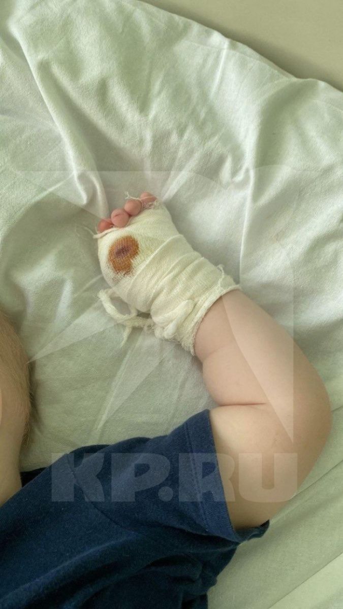 Дитина після нападу тигра, фото: «Комсомольская правда»