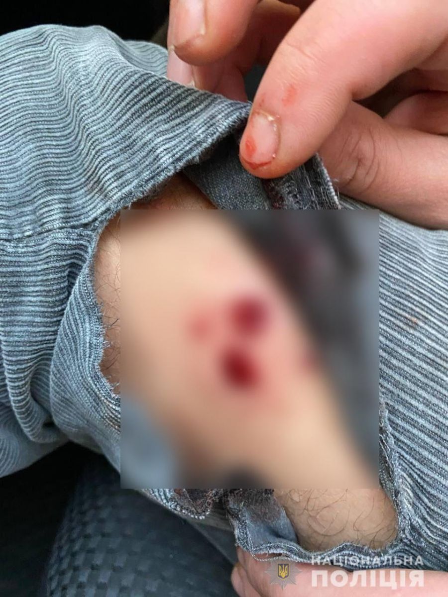 Під Києвом обстріляли подружжя з дитиною, які сідали в авто, фото - Нацполіція