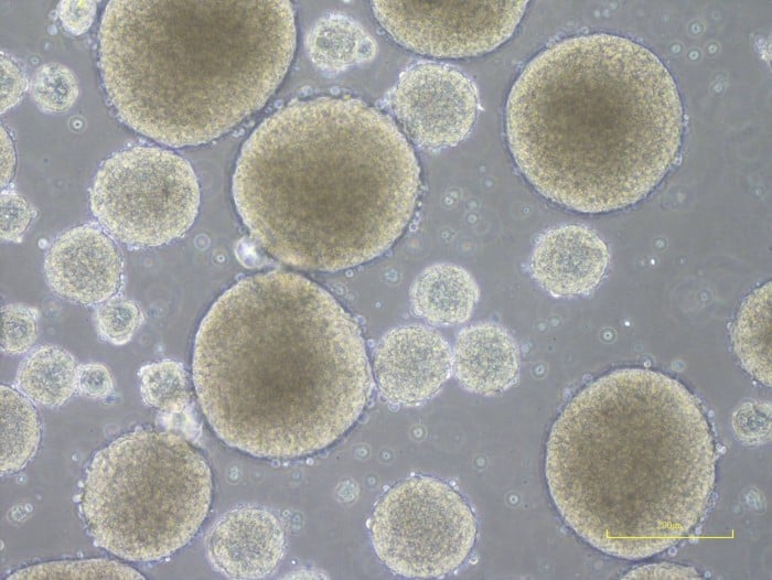 Клітини, отримані з клітин iPS і які переростуть у нервові клітини, фото: Університет Кейо