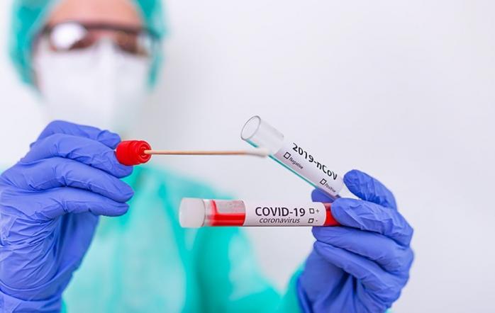 Не хуже ПЦР – ученые разработали быстрый тест на коронавирус=