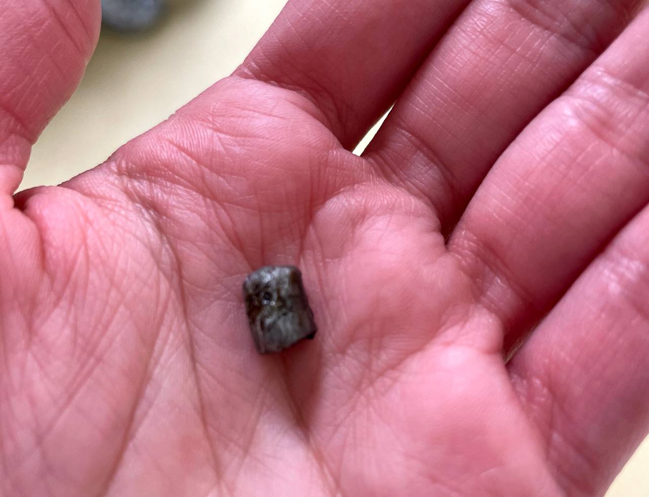 Лікарі «Охматдиту» дістали уламок російського снаряда з голови 13-річної дівчинки 