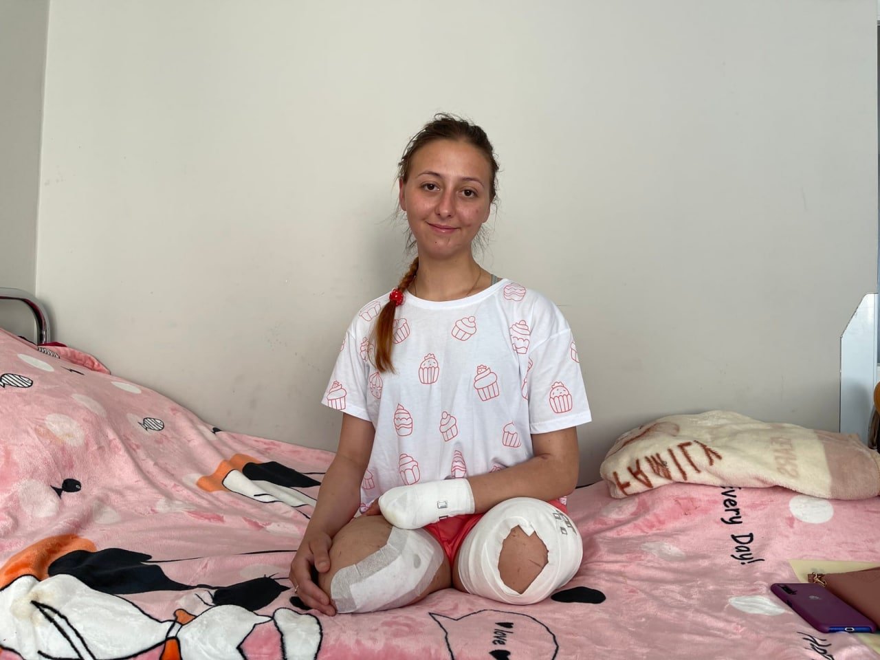 У Львові вийшла заміж медсестра, яка втратила ноги внаслідок вибуху в Лисичанську 