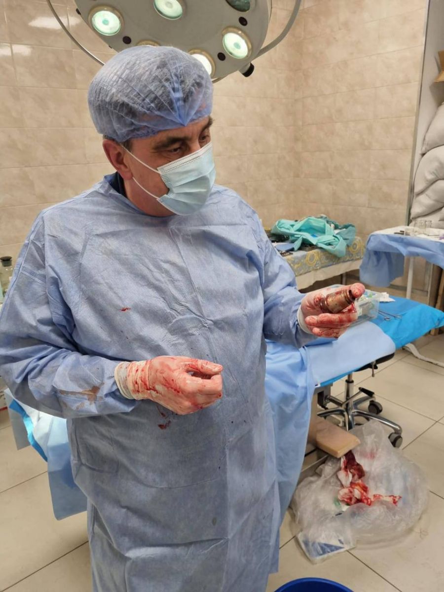 Унікальна операція - лікарі видалили з тіла військового гранату, яка не розірвалася