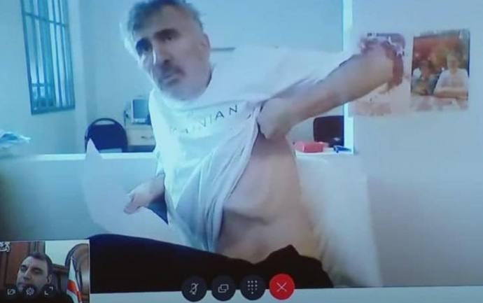 Саакашвили показал последствия содержания под стражей - кожа и кости 