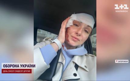  Две журналистки получили ранения во время повторного обстрела Запорожья