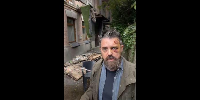 Режиссер Кристофер Уолтерс пострадал в результате падения балкона в Киеве, скриншот видео