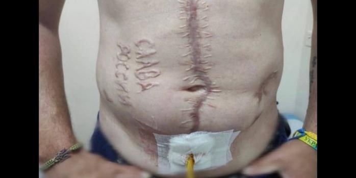 Освобожденный из плена военный показал следы увечий на своем теле, фото: Clash Reports