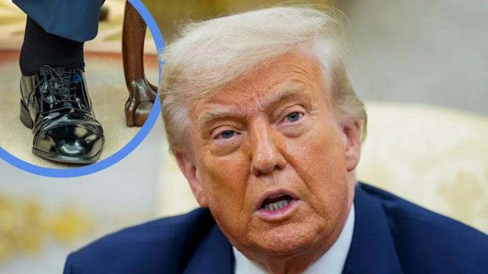 У Трампа діагностували хронічну хворобу вен, але Білий дім запевняє, що він у чудовій формі