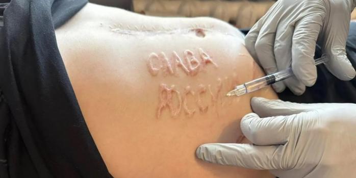 Рашисты вырезали надпись на животе пленного украинского военного, фото: New York Post