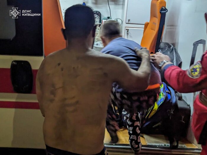 На Київщині через вибух зарядного пристрою виникла пожежа у квартирі, фото: ДСНС