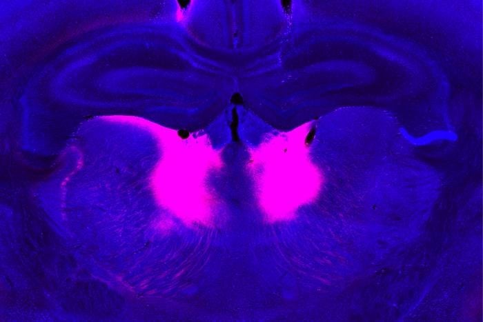 Дослідники з Массачусетського технологічного інституту (MIT) виявили нейрони в медіодоральному таламусі (позначені рожевим кольором), порушення функції яких може призвести до погіршення здатності коригувати свої переконання на основі нової інформації, джерело: MIT 