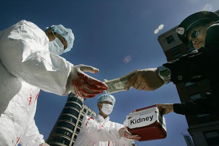 Поліція викрила канал трансплантації органів, серед потерпілих — підлітки (ФОТО, ВІДЕО)